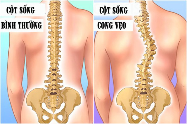 7 việc có thể khiến trẻ tổn thương não, gãy xương nhưng cha mẹ vẫn vô ý cho con làm  - Ảnh 2.