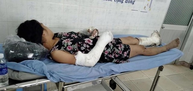 Thai phụ bị chồng đánh vỡ nền sọ, gãy tay bất ngờ trốn viện - Ảnh 1.