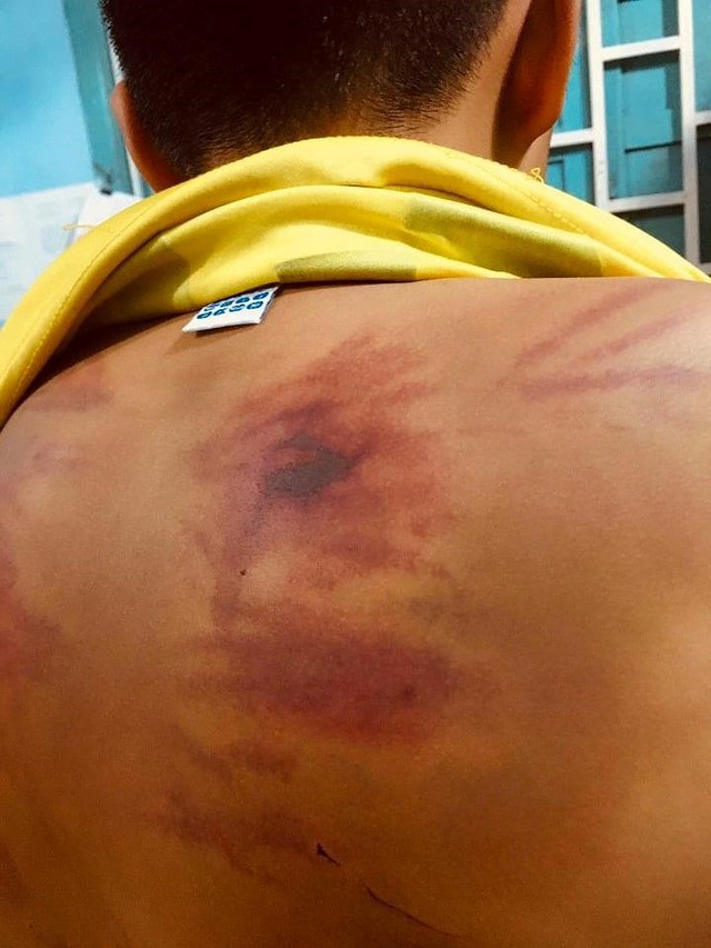 Bình Thuận: Bé trai 11 tuổi bị nhà tu hành đánh đập dã man - Ảnh 1.
