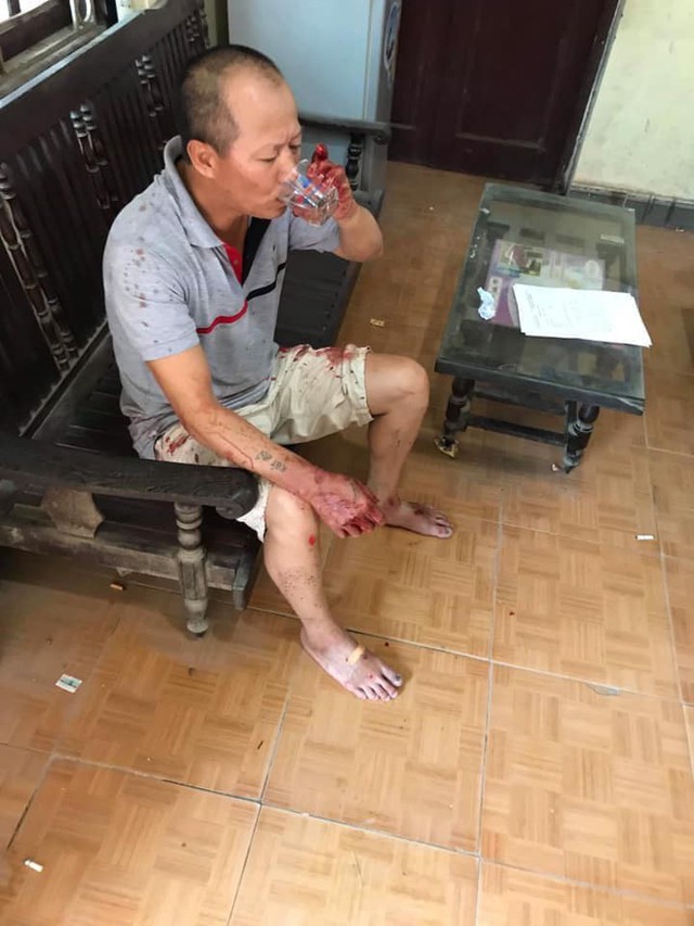 Vụ anh ruột chém cả nhà em trai ở Hà Nội: Nạn nhân thứ 3 tử vong - Ảnh 4.
