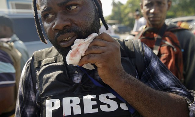 Nhà báo bị bắn vào mặt khi nghị sĩ nổ súng tự giải vây - Ảnh 2.