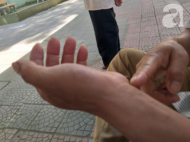 Bố của bé trai 10 tuổi bị người thân chém đứt lìa bàn tay ở Bắc Giang: Giờ tôi chưa dám lại nhìn con - Ảnh 4.