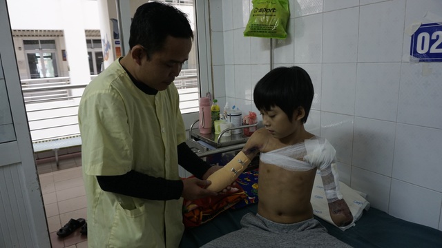 Cậu bé cụt hai tay sau điện giật Nguyễn Nhật Long phải ăn Tết ở bệnh viện - Ảnh 2.
