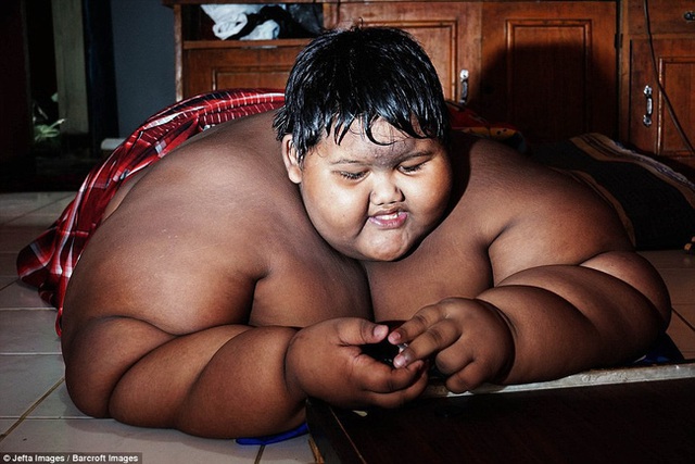 Cậu bé nặng nhất thế giới với gần 200kg sau 4 năm phẫu thuật thu nhỏ dạ dày giờ lột xác không ai nhận ra - Ảnh 3.