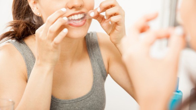 Những căn bệnh từ việc không đánh răng hàng ngày - Ảnh 5. Những căn bệnh từ việc không đánh răng hàng ngày - Ảnh 5.