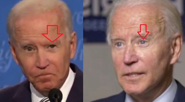 76 tuổi vẫn phong độ lịch lãm, ông Joe Biden để lộ bằng chứng nhiều lần phẫu thuật níu kéo tuổi xuân từ cấy tóc, căng da đến cắt mí - Ảnh 6.