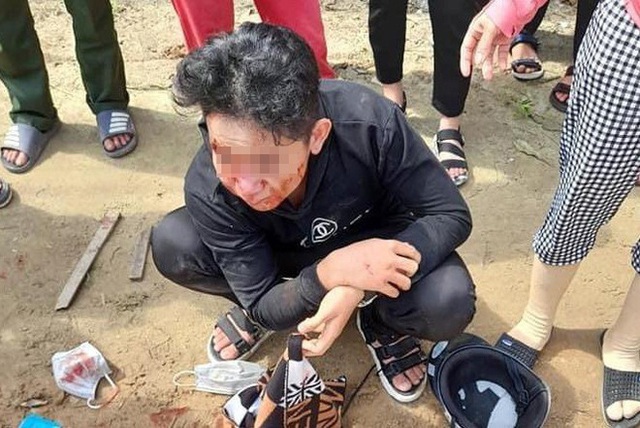 Học sinh ở Quảng Bình bị đánh bất tỉnh - Ảnh 1.