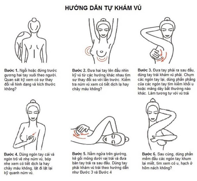 Cách sờ, nắn ngực để phát hiện bất thường ở vú, dự phòng nguy cơ mắc ung thư vú - Ảnh 3.