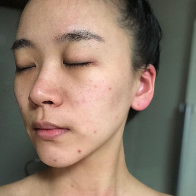 5 dấu hiệu cho thấy bạn đã chọn đồ skincare sai bét, không ngưng dùng ngay thì da càng xấu không lối thoát - Ảnh 3.