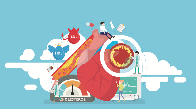 Tại sao Lipidcleanz là công thức góp phần kiểm soát cholesterol hiệu quả? - Ảnh 1.