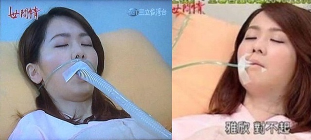 Phim Đài Loan cho bệnh nhân thở bằng ống to như vòi nước - Ảnh 2.