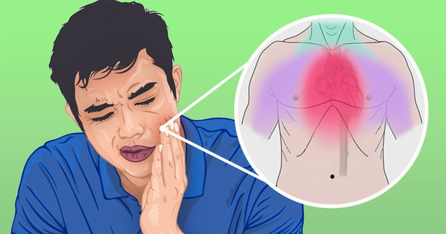 5 cơn đau khó hiểu khiến bạn dễ nhầm lẫn với đau răng nhưng có thể đó là dấu hiệu của những căn bệnh khó chữa - Ảnh 3.