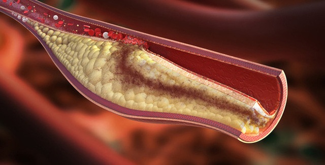 8 món ăn vặt dành riêng cho người có cholesterol cao, vừa rẻ bèo lại còn giàu dinh dưỡng - Ảnh 1.