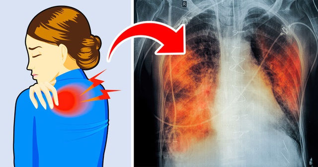 Có 5 dấu hiệu này chứng tỏ phổi của bạn đang kêu cứu, tuyệt đối không được chủ quan - Ảnh 1.