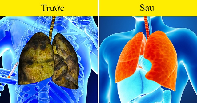 Có 5 dấu hiệu này chứng tỏ phổi của bạn đang kêu cứu, tuyệt đối không được chủ quan - Ảnh 6.