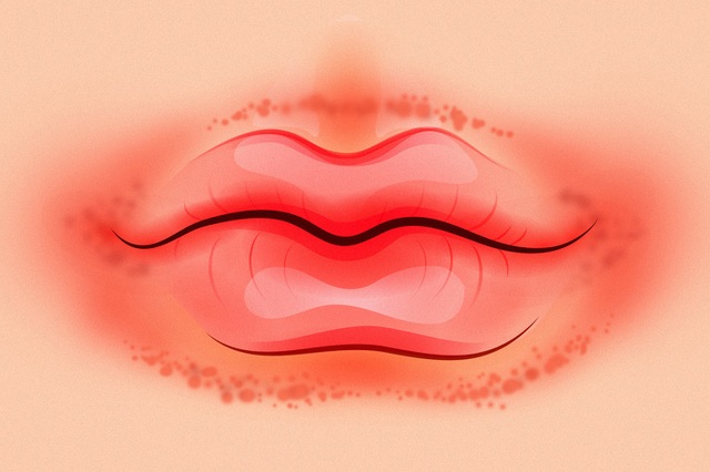 Chỉ cần nhìn 8 dấu hiệu này của môi, bạn có thể tự bắt bệnh cực chính xác - Ảnh 4.