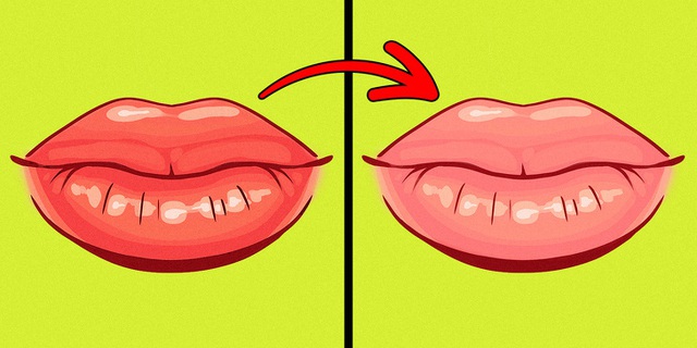 Chỉ cần nhìn 8 dấu hiệu này của môi, bạn có thể tự bắt bệnh cực chính xác - Ảnh 6.