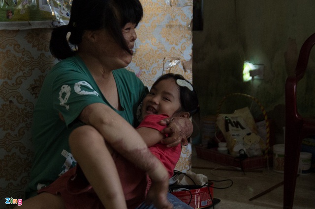 4 năm tìm lại bình yên của cô gái bị chồng tưới xăng thiêu sống - Ảnh 6. 4 năm tìm lại bình yên của cô gái bị chồng tưới xăng thiêu sống - Ảnh 6.