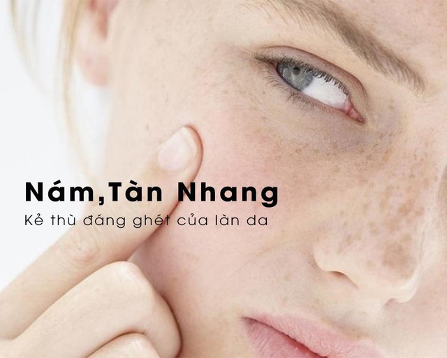 Giải pháp giúp cải thiện nám tàn nhang hàng đầu cho chị em - Ảnh 1.