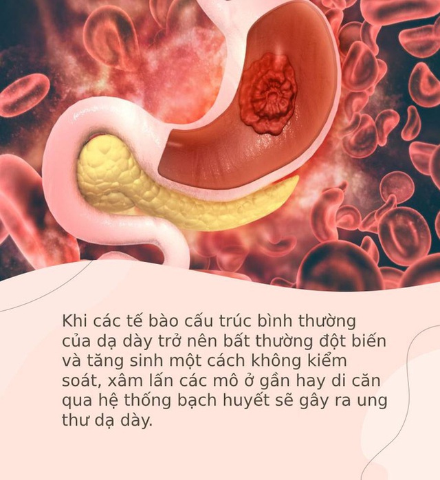 Hai căn bệnh cực kỳ phổ biến và rất dễ phát triển thành ung thư, bạn cần ngăn chặn ngay từ bây giờ - Ảnh 4.