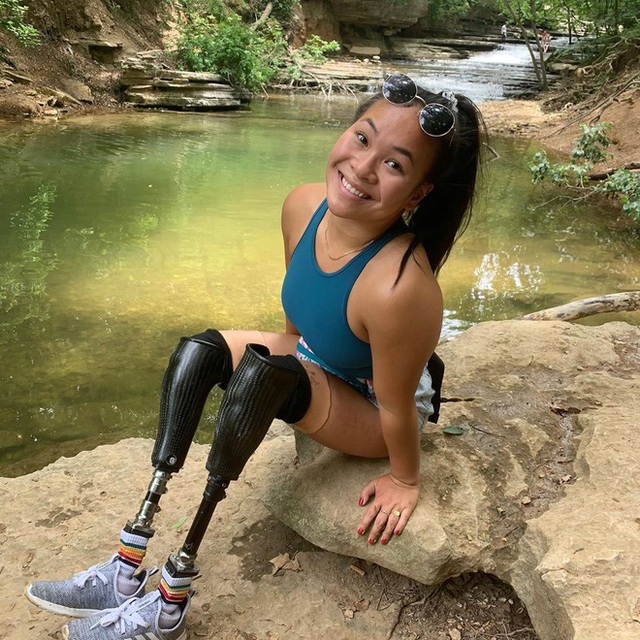 Cô gái gốc Việt mất 2 chân vì nổ bom, thành VĐV bơi lội ở Mỹ - Ảnh 1.