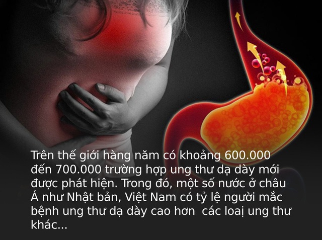 3 dấu hiệu bất thường ở bàn tay cho thấy dạ dày đang kêu cứu, ở độ tuổi nào cũng cần làm ngay 4 việc để ngăn cản ung thư hình thành - Ảnh 1.