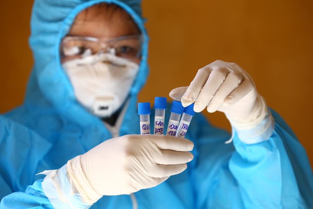 Việt Nam ghi nhận thêm 37 ca mắc COVID-19, 3 người ở TP HCM - Ảnh 2.