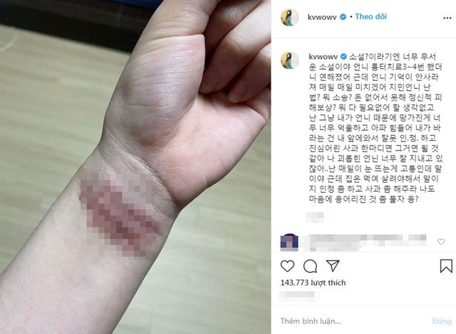 Nữ thần tượng Hàn nhiều lần tự tử vì bị bắt nạt suốt 10 năm - Ảnh 3.