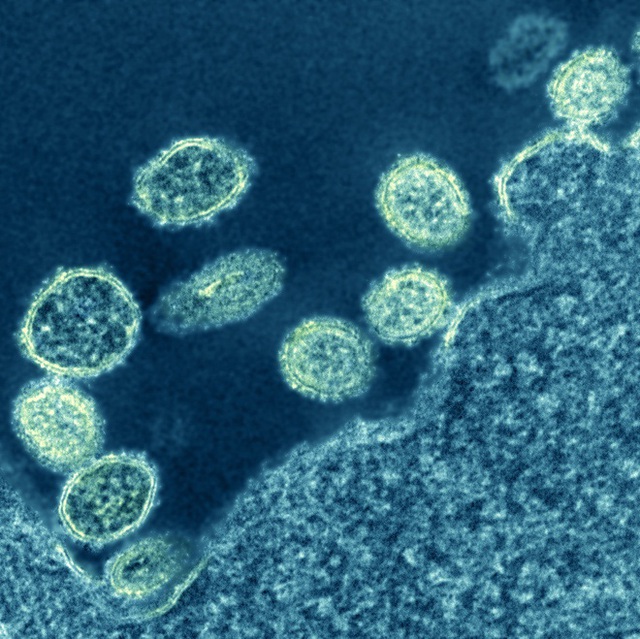 Chủng virus cúm mới được phát hiện ở Trung Quốc có nguy hiểm? - Ảnh 1.