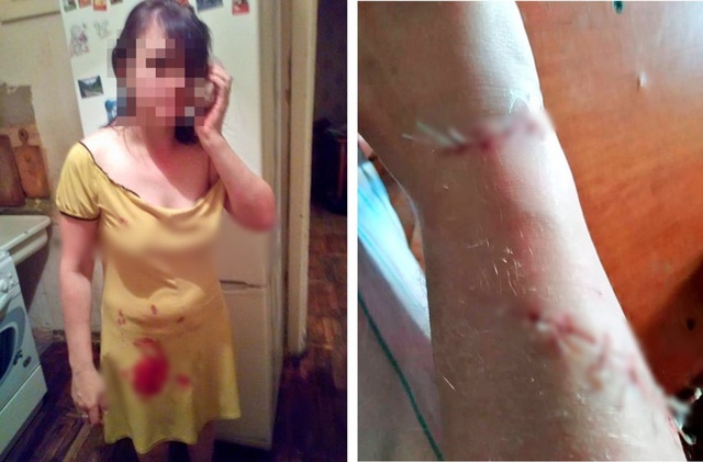 Trước sinh nhật tuổi 17, thiếu niên ra tay giết cha dượng để bảo vệ mẹ nhưng kết quả điều tra lại chỉ ra nhiều chi tiết khác về hung thủ - Ảnh 1. Trước sinh nhật tuổi 17, thiếu niên ra tay giết cha dượng để bảo vệ mẹ nhưng kết quả điều tra lại chỉ ra nhiều chi tiết khác về hung thủ - Ảnh 1.