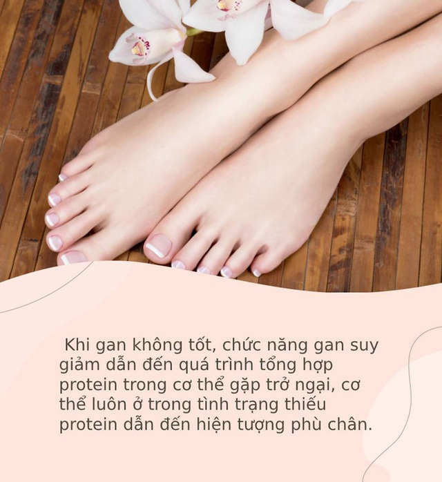Bàn chân giống như đồng hồ sức khỏe: 3 dấu hiệu này trên bàn chân cho biết rất có thể gan của bạn đang gặp vấn đề - Ảnh 3.