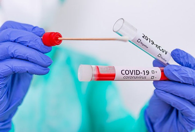 Người đầu tiên tái nhiễm Covid-19 sau hơn 4 tháng khỏi - Ảnh 3.