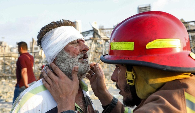 Nổ lớn ở Lebanon, 78 người chết, 4.000 nạn nhân bị thương - Ảnh 3.