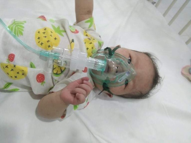 Xót xa bé 11 tháng tuổi thân hình yếu ớt cần tiền phẫu thuật tim gấp - Ảnh 2.