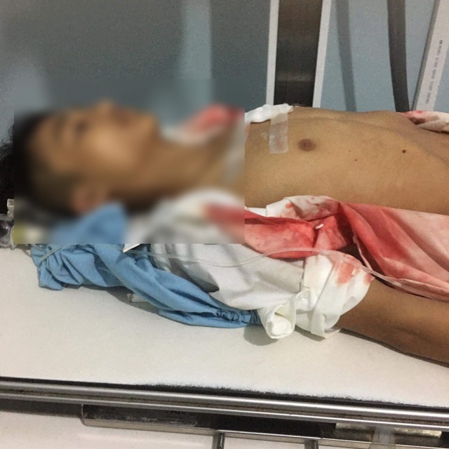 Hà Giang: 2 nhóm học sinh THPT đánh nhau, 1 em bị đâm thấu ngực - Ảnh 3.