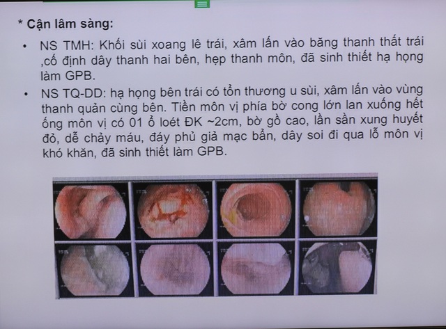 Chuyên gia Bệnh viện K hoàn thiện phác đồ khám chữa bệnh từ xa cho bệnh nhân đa ung thư hiếm gặp - Ảnh 3.