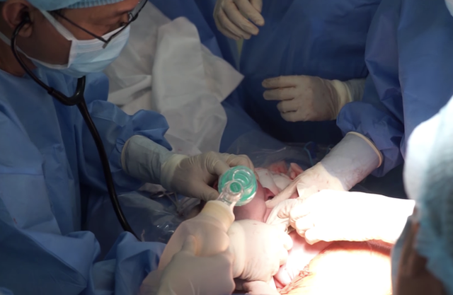 Bác sĩ hai bệnh viện Từ Dũ và Nhi Đồng 1 phẫu thuật EXIT cứu bé sơ sinh nửa trong, nửa ngoài bụng mẹ - Ảnh 1.