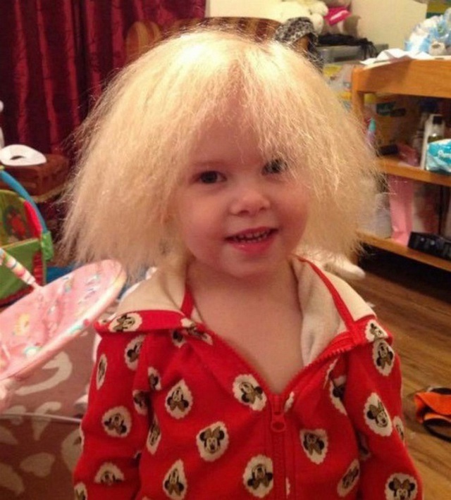 Cuộc sống của bé gái Anh có mái tóc giống thiên tài Vật lý Einstein - Ảnh 1.