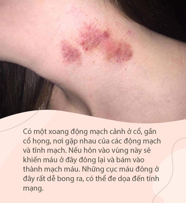 Khi hôn nhất định cần tránh 2 khu vực này, tuy mang lại hưng phấn nhưng có thể gây suy giảm thính lực, thậm chí tử vong - Ảnh 1.