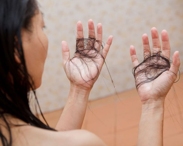 7 cách kiểm tra tình trạng tóc rụng - Ảnh 1.