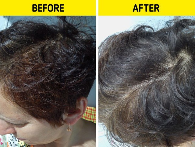 7 cách kiểm tra tình trạng tóc rụng - Ảnh 6.