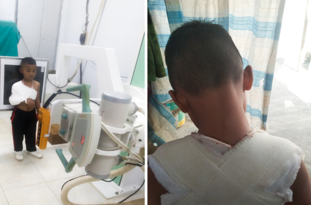 Sơn La: Bé trai 4 tuổi bị gãy xương đòn khi rời trường mầm non về nhà - Ảnh 1.