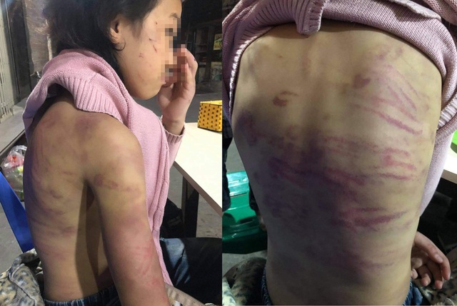 Trần tình của bà mẹ nhẫn tâm bạo hành con gái 12 tuổi ở Hà Nội - Ảnh 4.