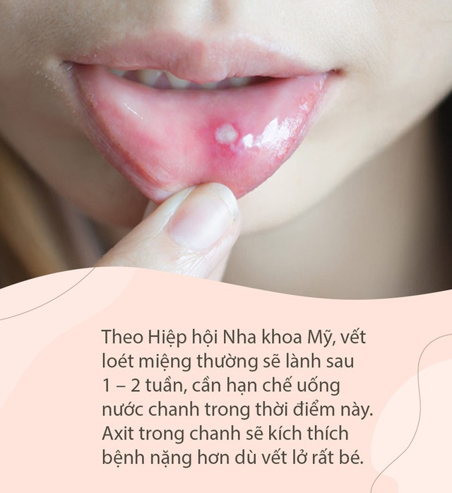 Uống nước chanh mỗi ngày rất tốt nhưng nếu có 5 dấu hiệu sau, phụ nữ nên bỏ ngay kẻo rước bệnh vào thân - Ảnh 4.