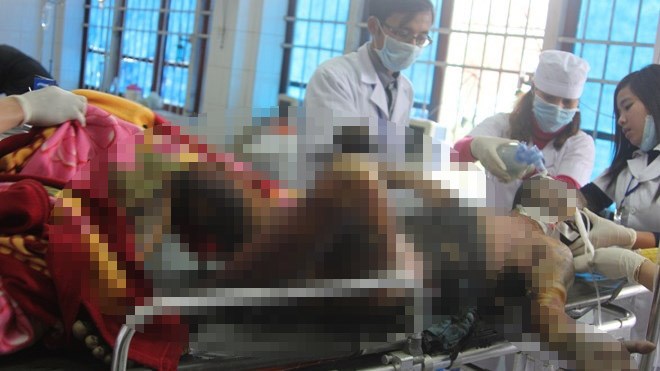Tưới xăng tự thi&ecirc;u, nam thanh ni&ecirc;n nguy kịch 1
