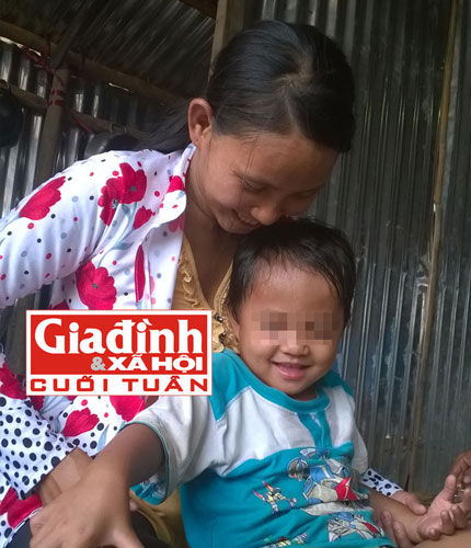 Cháu bé sinh ra đã có 2 “của quý”: Bệnh viện Tâm Trí Sài Gòn sẵn lòng mổ miễn phí 1