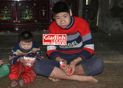 Chuyện đau lòng trong gia đình những đứa trẻ sinh ra đều mang hình hài của… khỉ 1
