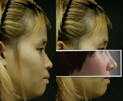 C&ocirc; g&aacute;i "nam t&iacute;nh" phải phẫu thuật để giống phụ nữ 3