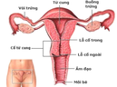 8 dấu hiệu lạ cảnh báo bạn bị ung thư cổ tử cung 8 dấu hiệu lạ cảnh báo bạn bị ung thư cổ tử cung