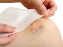 Dấu hiệu cảnh báo ung thư máu bạn thờ ơ bỏ qua mà không hay biết Dấu hiệu cảnh báo ung thư máu bạn thờ ơ bỏ qua mà không hay biết